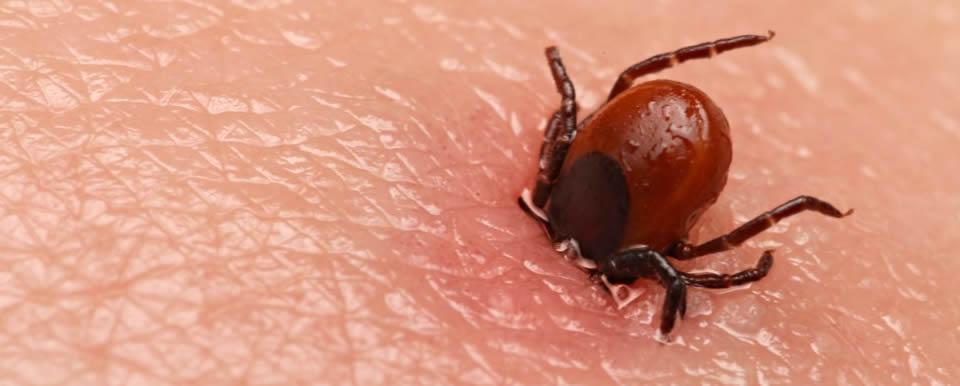 Como identificar picada de percevejo de cama Como identificar picada de percevejo de cama?